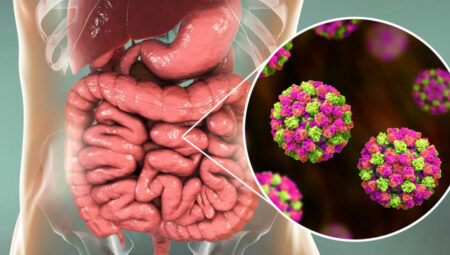 Dünyanın yeni salgını noravirüs: Nedir belirtileri neler nasıl korunulur?